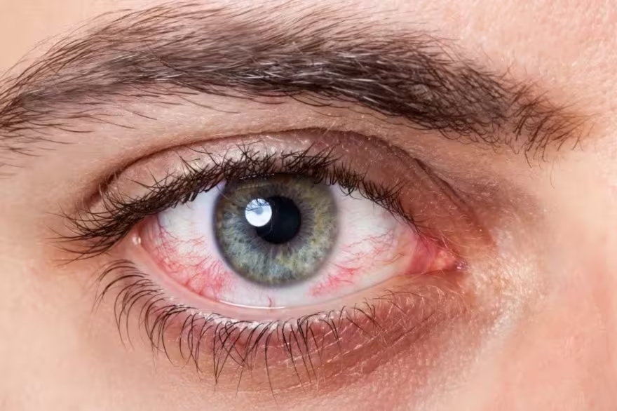 Cinco recomendaciones para el cuidado de nuestros ojos por uso excesivo de pantallas