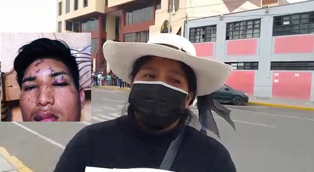 Alumno de escuela de la PNP desfiguró el rostro de su vecino, pero fiscal archivó la denuncia