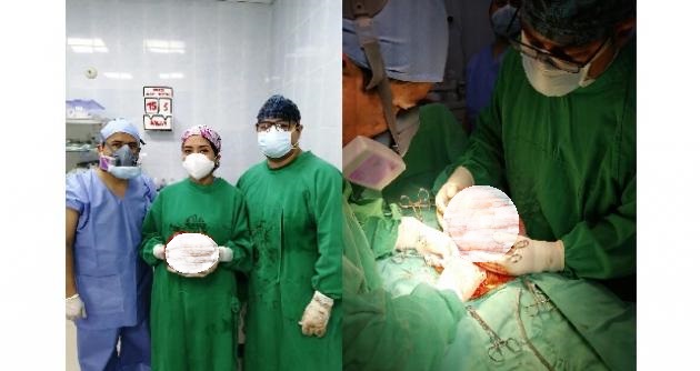 Médicos de hospital de Chimbote extirpan 3 tumores gigantes a pacientes mujeres