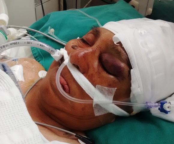 Responsabilizan a personal de Hospital III de EsSalud por muerte cerebral de paciente