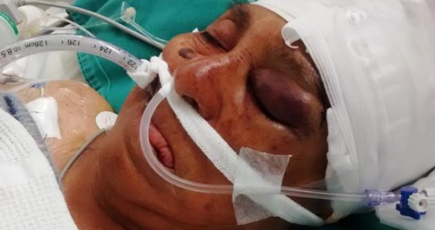 Hospital III de EsSalud anuncia investigación por muerte cerebral de paciente