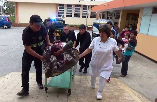 Delincuentes golpearon con un fierro en la cabeza a albañil y murió en hospital de Nuevo Chimbote