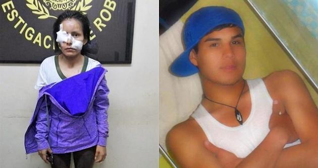 Nuevo Chimbote: alcalde Valentín Fernández ofrece ayuda a mujer desfigurada por su pareja