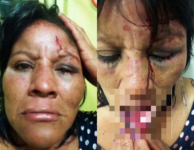 Detienen a vigilante por golpear salvajemente a su expareja de Chimbote porque se negó a regresar con él