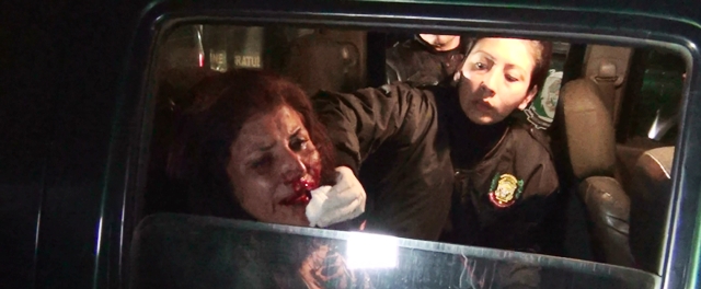 Sujeto ebrio golpea y arranca labio de un mordisco a su esposa