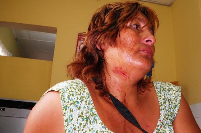 Chimbote: mujer clava desarmador en el cuello de su vecina