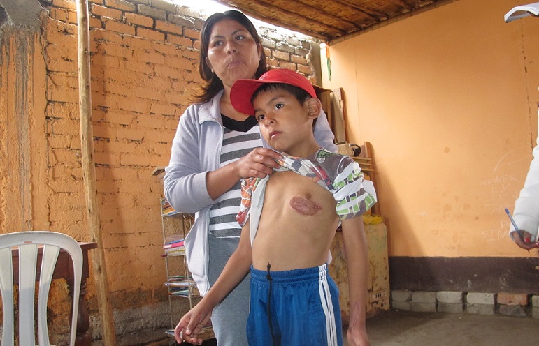  Madre de niño que sufrió descarga eléctrica en Monte Chimbote pide ayuda