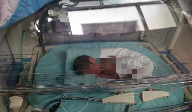 Chimbote: bebé prematuro requiere traslado urgente a hospital de Lima para no perder la vista