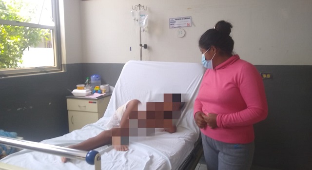Niño de 6 años que sufrió graves quemaduras en su cumpleaños requiere ayuda en hospital de Chimbote