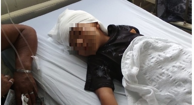 Niño sufrió el ataque salvaje de un perro pitbull en Chimbote, le hizo una herida grave en la cabeza