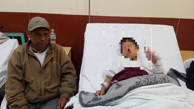 Niño pierde 3 dedos de su mano al estallar explosivo de una “vaca loca” en fiesta patronal en Sihuas