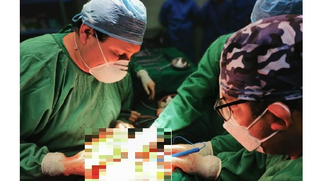 Oncólogos realizan cirugía exitosa a paciente con cáncer al hígado y colon en Nuevo Chimbote