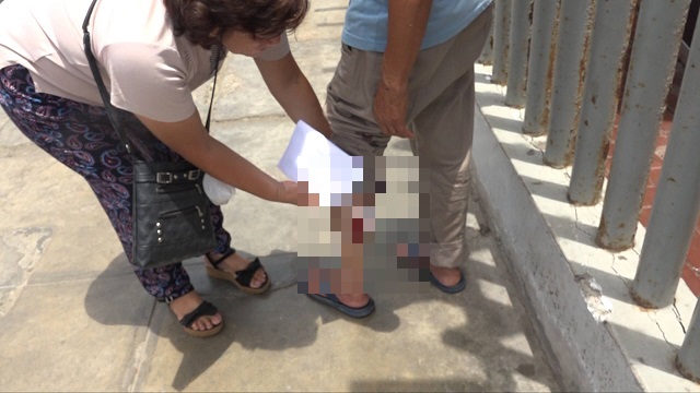 Pitbull ataca a anciano de 78 años cuando caminaba por “Magdalena Nueva” en Chimbote, nadie lo auxilió