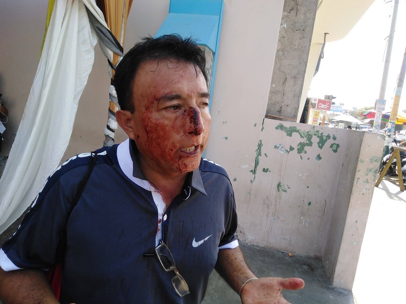 Áncash: periodista sufre brutal agresión por parte de empresario invasor de terrenos en “La Carbonera” 