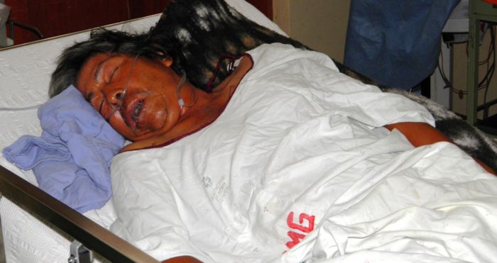 Pescador “pepeado” por una mujer lleva cinco días en estado de coma