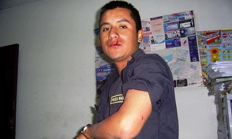 Chofer borracho atacó brutalmente a policía que lo intervino