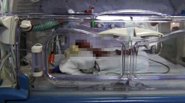 Joven dio a luz en los servicios higiénicos de policlínico en Chimbote, no sabía que estaba embarazada