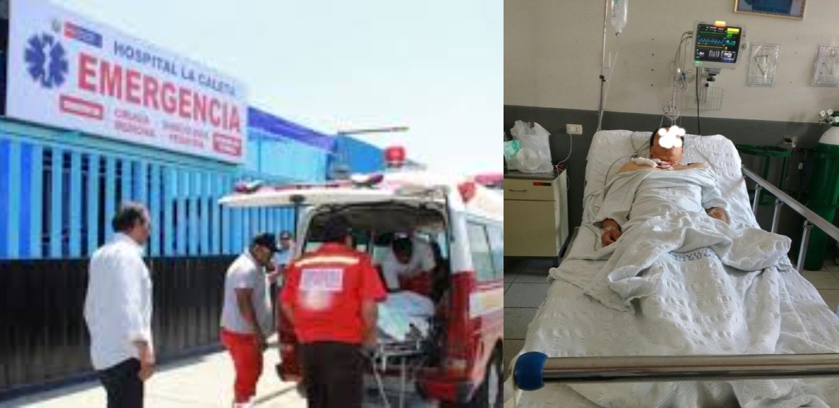 Chimbote: obrero casi pierde la vida cuando manipulaba herramienta de trabajo