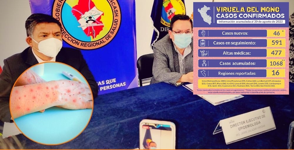 Ministerio de Salud reporta 4 casos de la viruela del mono en Áncash